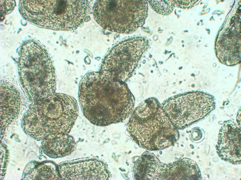 Protoscolices Echinococcus multilocularis microscopic photo of being released 库存照片