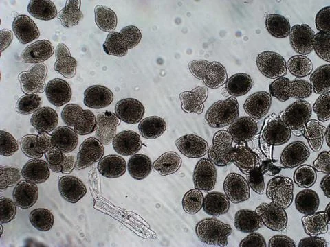 Protoscolices Echinococcus multilocularis microscopic photo of being released Stock Photos
