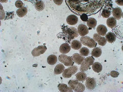 Protoscolices Echinococcus multilocularis microscopic photo of being released Stock Photos