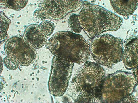 Protoscolices Echinococcus multilocularis microscopic photo of being released Stock Photos