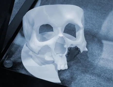 Prototype human skull from white plastic implant from biocompatible titanium Stock Photos