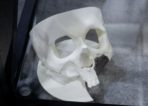 Prototype human skull from white plastic implant from biocompatible titanium Stock Photos