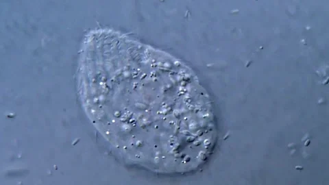 Protozoa and bacteria under microscope, Ciliate Protozoa parasite Vídeos de archivo 317140435