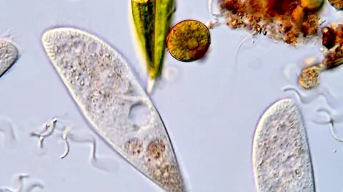 Protozoa and green algae under DIC microscope Vídeos de archivo 317789791