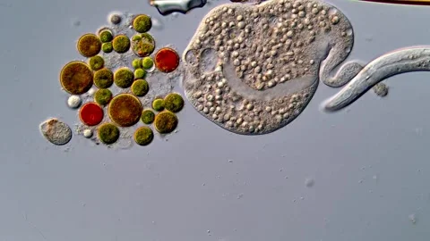 Protozoa and nematode under DIC microscope, Dileptus and nematode larvae Vídeos de archivo 310356313