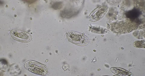 Protozoa, ciliate, Stylonychia group swimming medium power Stock Footage