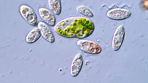 Protozoa Ciliates in Microbial Ecosystem, 400x Stock Footage 317887051
