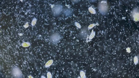 Protozoa ciliates, paramecium with algae Vídeos de archivo 324774994