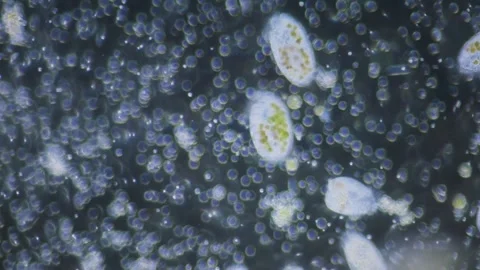 Protozoa ciliates, paramecium with algae Video stock 324834412