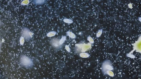 Protozoa ciliates, paramecium with algae Video stock 324834424