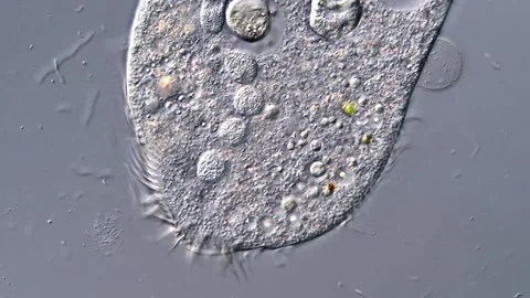 Protozoa detail under DIC microscope view 400x magnification 库存影片 316997576