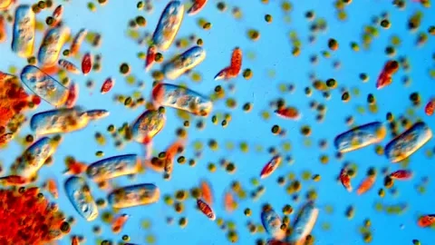 Protozoa life under DIC microscope 400x magnification 스톡 동영상 318246967