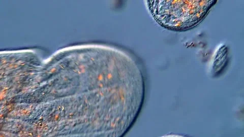 Protozoa life under DIC microscope 库存影片 318247860