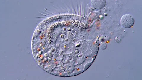 Protozoa Membrane Rupture Seen Under Magnification,  400x 動画素材 317106319