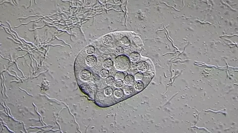 Protozoa microorganism under microscopy view 库存影片 306576735