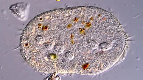 Protozoa microorganism under microscopy view High Resolution 库存影片 316997553