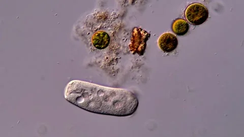 Protozoa in pond water under microscope 库存影片 310641913