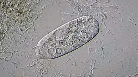 Protozoa in pond water under microscopy view, 400x magnification Vídeos de archivo 306576971