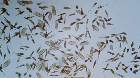 Protozoa single cell organisms in microscope bright field Stock Footage 164953465