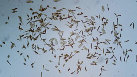 Protozoa single cell organisms in microscope bright field Stock Footage 164953906