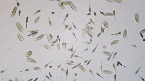 Protozoa single cell organisms in microscope bright field Stock Footage 164954357