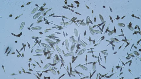 Protozoa single cell organisms in microscope bright field Stock Footage 164954366