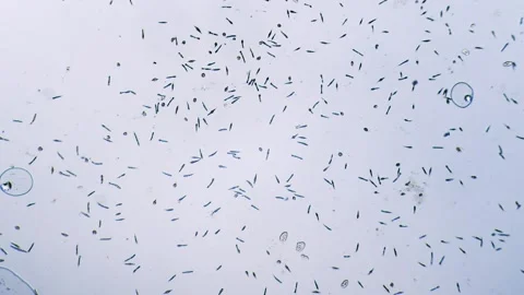 Protozoa single cell organisms in microscope bright field Stock Footage 164954514