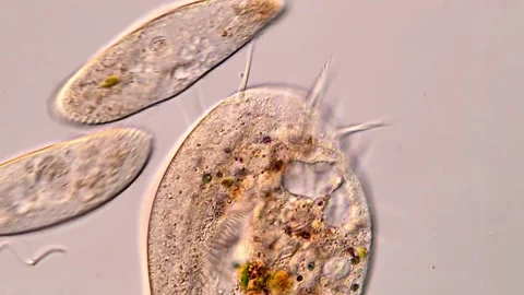 Protozoa swimming under DIC microscope, 400x magnification 库存影片 317171036