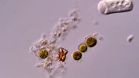 Protozoa under microscope 400x magnification 库存影片 310641916