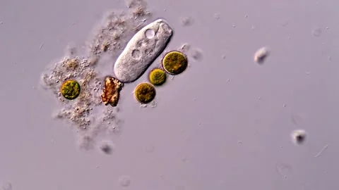 Protozoa under microscope 库存影片 310641911