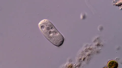 Protozoa under the microscope, Free swimming Vorticella 库存影片 310641968