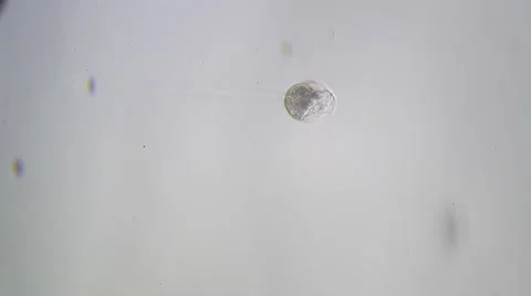Protozoa Vorticella Microscopy Stock Footage 60004954