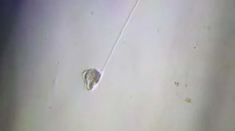 Protozoa Vorticella Microscopy Stock Footage 60004964