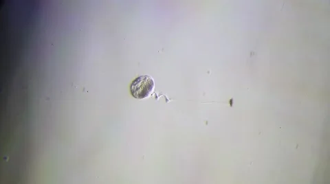 Protozoa Vorticella Microscopy Stock Footage 60004968