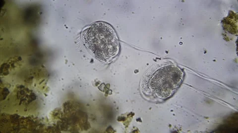 Protozoa Vorticella Microscopy Stock Footage 60004982