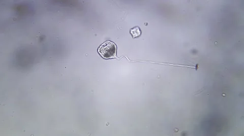 Protozoa Vorticella Microscopy Stock Footage 60004985