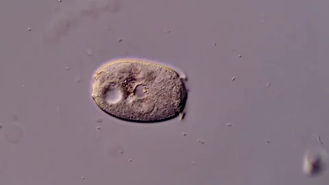 Protozoa Vorticella under microscope view 库存影片 310641963