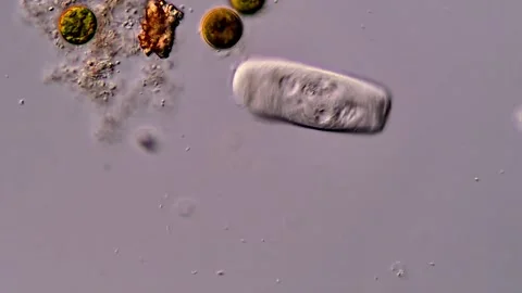 Protozoan in pond water under microscope 库存影片 310641915
