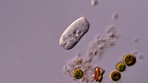 Protozoan in pond water under microscope 库存影片 310641958