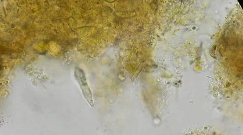 Protozoan under microscope Video stock 35169581