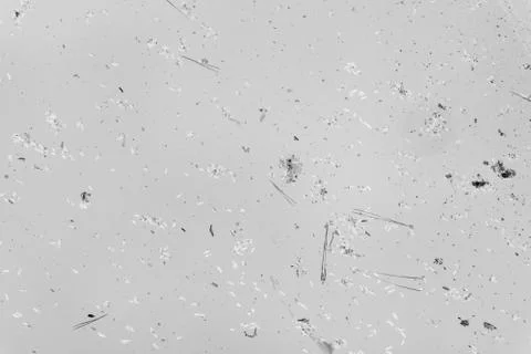 Protozoon Stock Photos