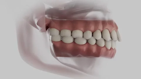 Protruding Teeth Correction Stock Footage 317321982