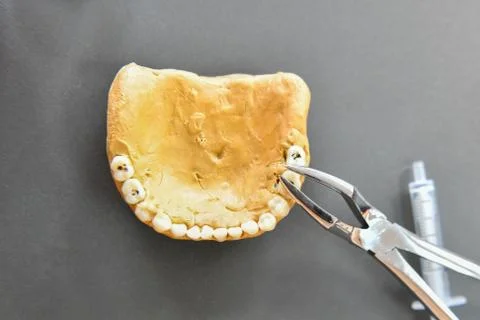Pry out teeth on the breadboard. Teaching Dentistry. tongs and teeth. toothac Foto stock
