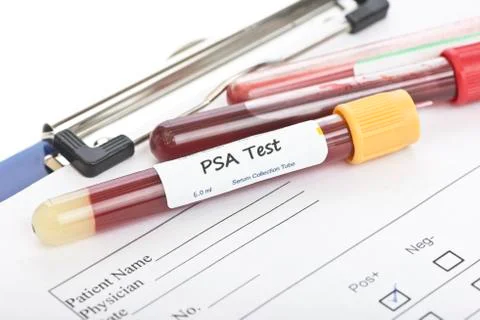 PSA Test Stock Photos