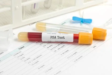 PSA Test Stock Photos