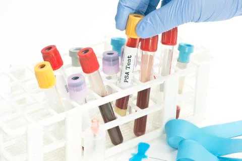 PSA Test Stock Photos