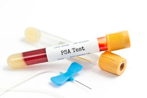PSA Test Stock Photos