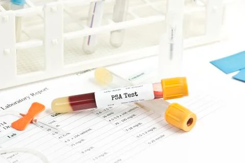PSA Test Stock Photos