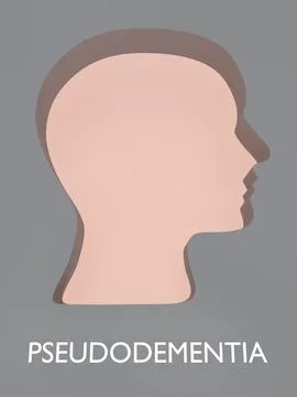 Pseudodementia - mental concept Stock Illustration