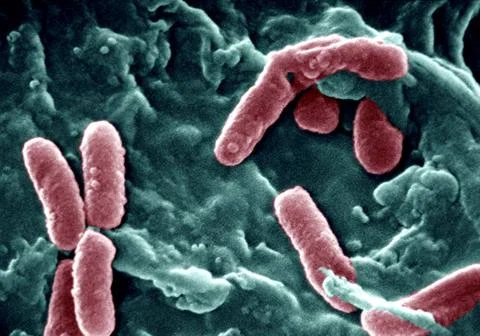  Pseudomonas aeruginosa Scanning Electron Micrograph. This bacillus causes... Stock Photos